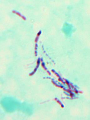 Lifescience) niepowodzenie identyfikacji gatunku Posiew na Columbia agar (+5% krew barania) oraz pożywkę