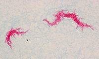 wzrostu Różnicowanie Corynebacterium, Rhodococcus i Nocardia -?