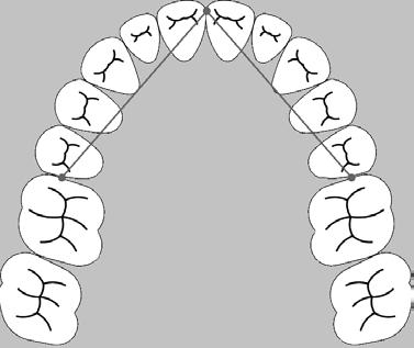 Distance between mesial surface of upper first molar and mesio incisal angle of central incisor Ryc. 2.