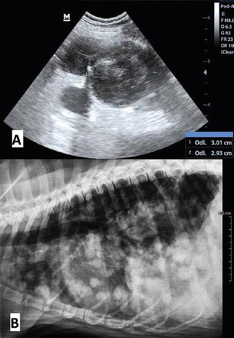 plazmacytomy złośliwe, nisko zróżnicowane mastocytomy, czerniaki amelanotyczne i bogatokomórkowe naczyniakomięsaki).