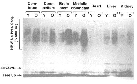 Annals of the New York Academy of Sciences 928:54-64 (2001) 2001 New York Academy of Sciences Implications of Protein Degradation in Aging Sataro Goto a, Ryoya Takahashi a, Atsushi Kumiyama a, Zsolt