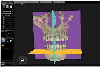 _CBCT Ryc. 2_Przykładowy wynik badania (10x10 cm). Jest to pierwsze okno obrazowe,które ukazane zostanie zaraz po otworzeniu badania.