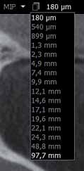 _CBCT Ryc. 5 Ryc. 6 Ryc. 7 Ryc. 7.1 Ryc. 7.2 Ryc. 5_Funkcja nieprzezroczystości. Umożliwia pokazanie tkanek oraz struktur znajdujących się wewnątrz badanej okolicy.
