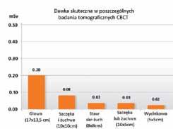 Wybierają więc formy obrazowania rtg (pantomogram, zdjęcie punktowe), które niestety w bardziej skomplikowanych przypadkach nie dają wystarczających informacji diagnostycznych.