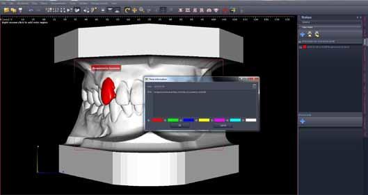 Jest to oprogramowanie przeznaczone do planowania implantacji, a także zabiegów ortognatycznych z wykorzystaniem tomografii komputerowej oraz skanów modeli laboratoryjnych zapisanych w