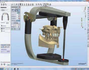 The starting point for CAD/CAM work is a carefully filled out order form in a software program (Fig. 3).
