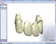 The form also specifies the milling centre to be used for manufacture, as well as the abutment library to be used.