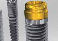 (BEGO Implant Systems) _magazine TWÓJ