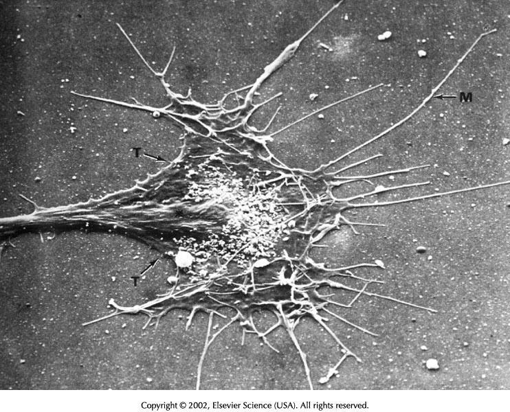 Ramon y Cajal po raz pierwszy użył nazwy stożek wzrostu aksonu Stożek