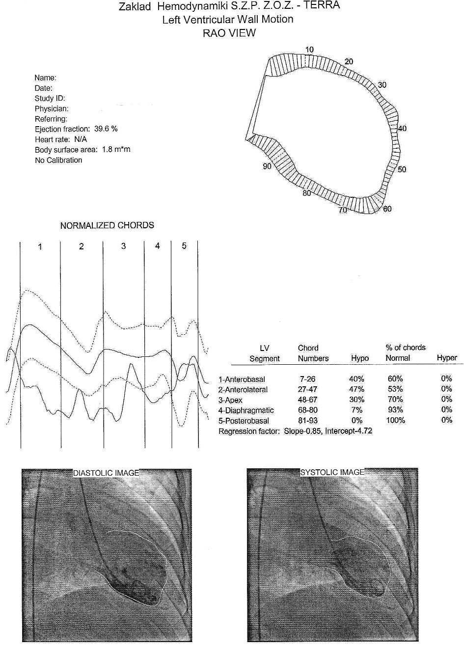 Ryc. 2. Rozkurcz i skurcz lewej komory Fig 2.