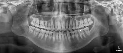 Efektywny 3w1 Dentystyczny System RTG CBCT > > Precyzyjne anatomiczne struktury 3D dokładna diagnoza dla