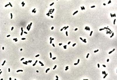 Corynebacterium Corynebacterium to Gram-pozytywne, tlenowe, nieruchliwe, pałeczki. W preparacie mikroskopowym układaja się na kształt pisma klinowego.