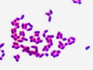Patogenność Do zakażenia Corynebacterium diphtheriae dochodzi przez błony śluzowe. Toksyny: toksyna błonicza działa cytotoksycznie i hamuje syntezę białek w komórkach eukariotycznych.
