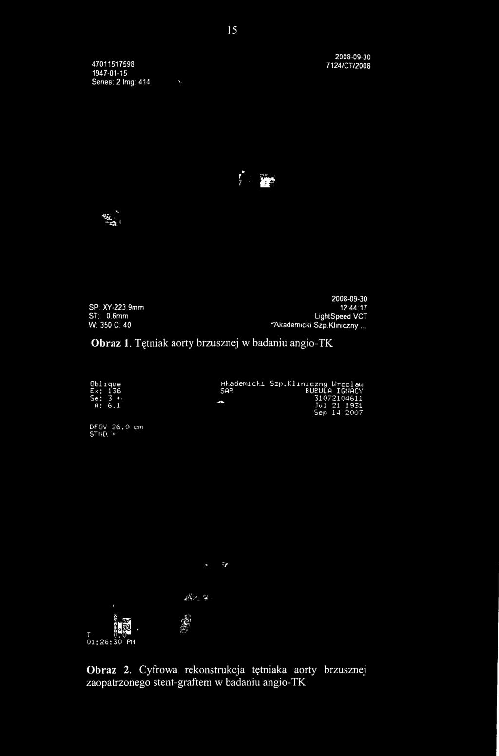 6mm W; 350 C: 40 2008-09-30 12:44;17