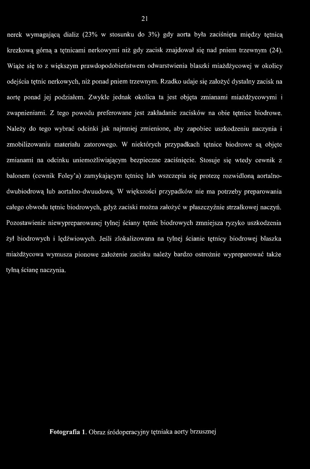 Należy do tego wybrać odcinki jak najmniej zmienione, aby zapobiec uszkodzeniu naczynia i zmobilizowaniu materiału zatorowego.