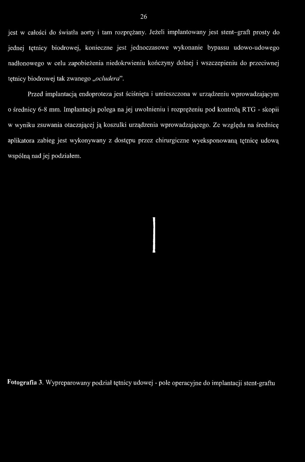 nadłonowego w celu zapobieżenia niedokrwieniu kończyny dolnej i wszczepieniu do przeciwnej tętnicy biodrowej tak zwanego ocluderd\