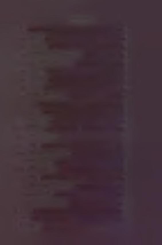 3 Spis treści 1. Wstęp... 4 1. 2. Terminologia... 4 1. 2. Rys historyczny... 5 1.3. Epidemiologia tętniaków aorty brzusznej... 6 1. 4. Zarys anatomiczny i histologiczny...8 1. 5. Patofizjologia.