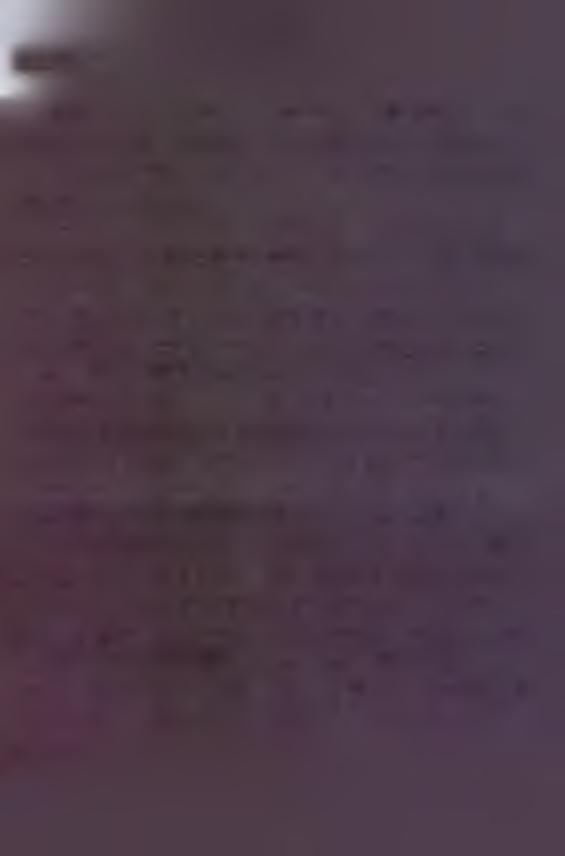 Współczesne tomografy spiralne, w tym posiadany przez Akademię Medyczną, mogą w jednym cyklu lampy wykonać akwizycję kilkudziesięciu (np.