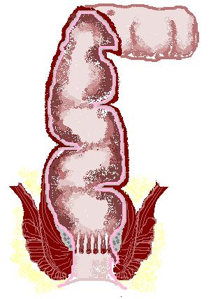 1.2. Anatomia kanału odbytu Chirurgicznie i czynnościowo kanał odbytu ma 4 cm długości i rozciąga się od kresy odbytowo-odbytniczej, na wysokości pętli dźwigacza odbytu, do bruzdy międzyzwieraczowej