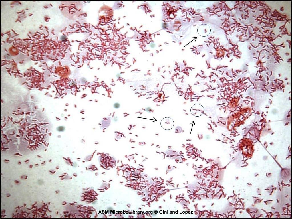 Klasyfikacja Rodzina Campylobacteraceae,Rodzaj : Campylobacter i Arcobacter.