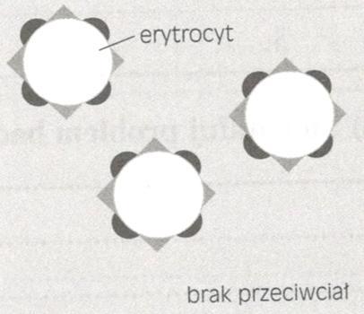 Zadanie 24. (0-3 pkt.) Wyróżnia się 4 główne grupy krwi: A, B, AB i 0. Grupa krwi człowieka warunkowana jest obecnością lub brakiem na powierzchni erytrocytów odpowiednich antygenów.