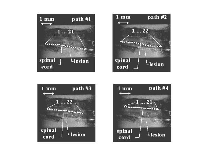 2.3.4 A. Krzyżak, A. Jasiński, W. P Węglarz,. Adamek, P. Sagnowski, M. Baj: Visualisation of the extent of damage in a rat spinal cord injury model using MR microsopy of the water diffusion tensor.