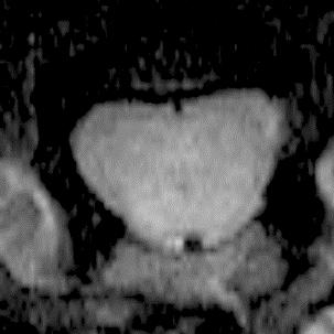 2.3.6 A. Krzyżak, A. Jasiński, S. Kwieciński, P. Kozłowski,. Adamek: Quantitative Assessment of Injury in Rat Spinal Cords In Vivo by MRI of Water iffusion Tensor.