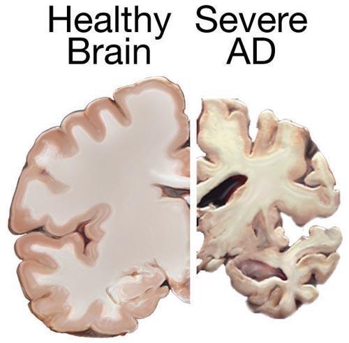 Metody obrazowania mózgowia Struktura - CT, MRI Fizjologia - MRS, angio-mr, angio-ct Biologia