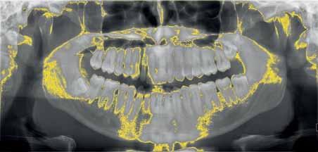 _obrazowanie Nowoczesne technologie obrazowania w stomatologii Autor_ Mateusz Szkliniarz Ryc. 1_Wyświetlenie obszarów o identycznej gęstości tkanek. Ryc. 2_Zdjęcie rtg wewnątrzustne zębowe.
