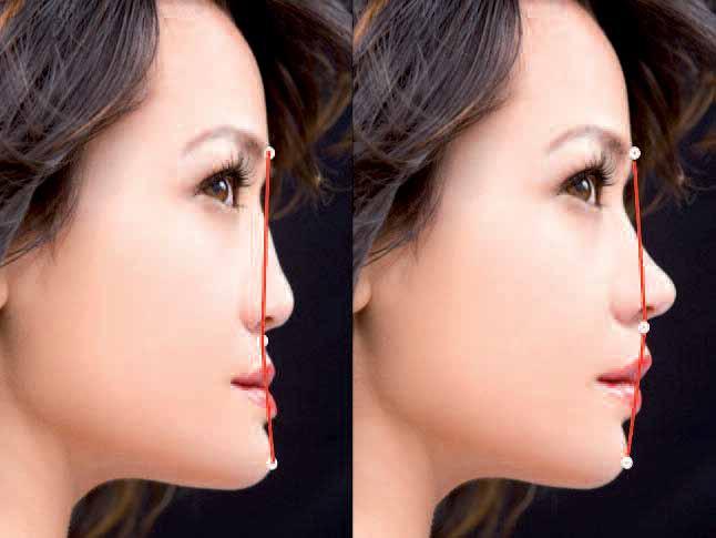 of the individual teeth, and finally moving to material selection considerations. Multiple photographic views (e.g., facial and sagittal) facilitate this analysis.
