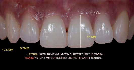 1 The length of teeth also affects aesthetics. Maxillary central incisors average between 10 mm and 11mm in length.