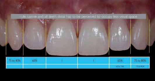 10 The aesthetic zone for central incisor length, according to the authors, is between 10.5mm and 12mm, with 11mm being a good starting point.