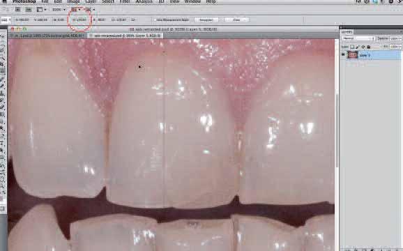 _smile analysis and smile design Fig. 23 Fig. 24 Fig. 25 Fig.