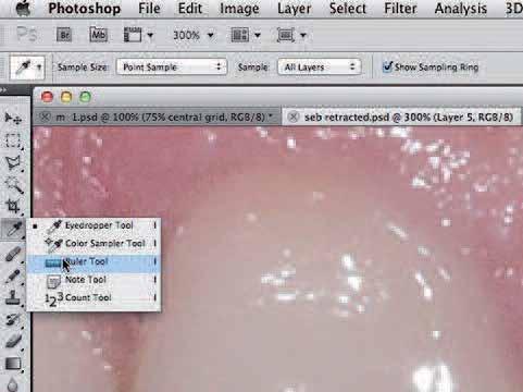 Follow these recommended steps: _To begin creating a tooth grid, use a cheek-retracted image of an attractive smile as a basis (e.g., one with a 75% width-to-length ratio).