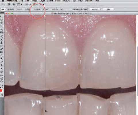 _To begin tracing the tooth grid, activate a selection tool, move to the tool palette, and select either the polygonal lasso tool or the magnetic lasso tool.