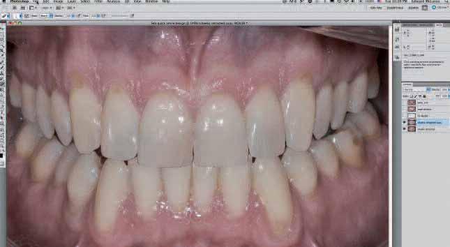 To enlarge or shrink the tooth grid created (with the layer activated), press command (or control) and t to bring up the free transform function.