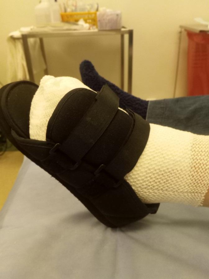 Extremely popular method of treating complications of diabetes as difficult to heal ulcers within feet of shoes is to use the reliever.