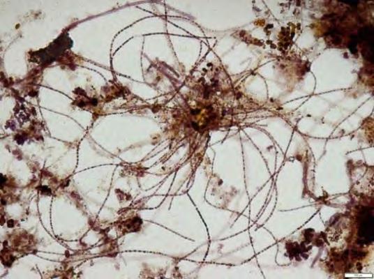Możliwościom rozwoju bakterii, takich jak Microthrix parvicella, sprzyjają zaawansowane technologie oczyszczania ścieków, w których głównym czynnikiem jest proces biologicznego usuwania biogenów