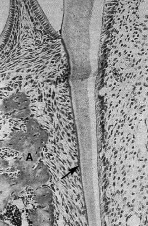 cementoblasty osadzają się na cemencie bezkomórkowym i otaczają się
