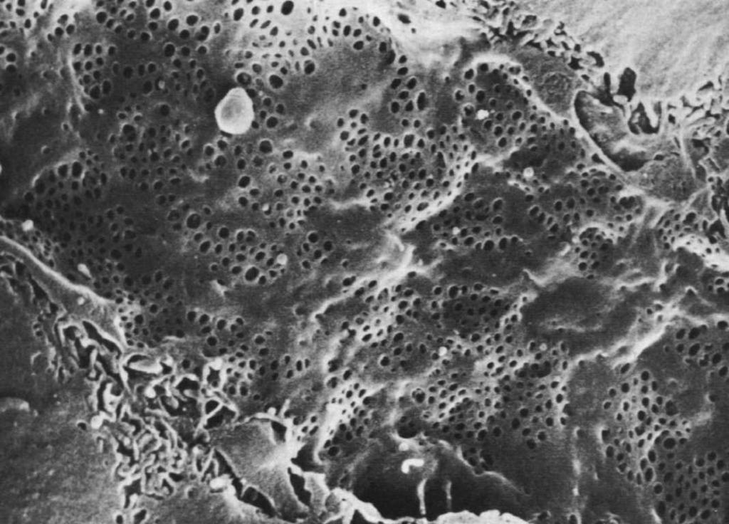 żółciowy (symetryczne wpuklenia błon komórkowych) z mikrokosmkami