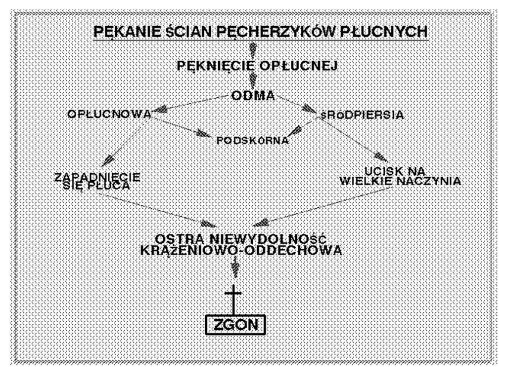 Objawy I ból w klatce piersiowej duszność sinica kaszel, krwioplucie