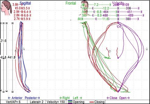 Assessment of temporomandibular dysfunction therapy progress based upon... J Stoma 2012; 65, 3 