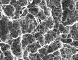 Powierzchnia Implantu NeO Hybrydową powierzchnię NanoTec TM implantu NeO uzyskuje się za pomocą skomplikowanego procesu piaskowania, dzięki któremu tworzy się struktura o większych cząsteczkach