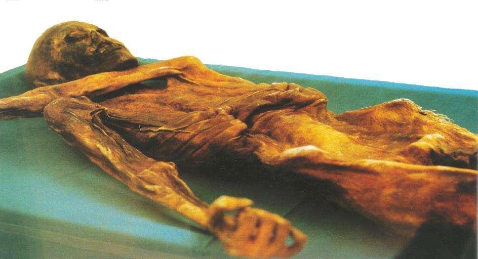 Ötzi