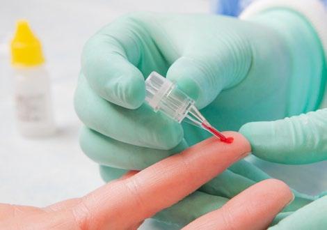 Krok 2 korzyści Przygotowanie próbki trwa kilka minut i wymaga niewielkiej ilości materiału biologicznego.