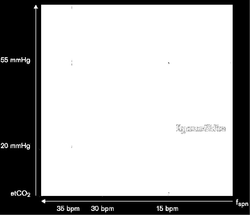 300 ml etco2: < 55mmHg Na podstawie wprowadzonej IBW, rozpoznania (COPD lub zaburzenia