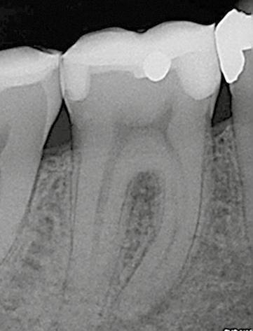 Praktyka _ Endodoncja stępny w przypadku większości stomatologicznych systemów owych.