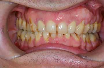 chirurgia periodontologiczna itp.).