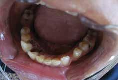 _kontakt Masoud Shabani Oral Health Department Official complex of Ardebil University of Medical Sciences Daneshgah Street 5618985991, Ardebil,