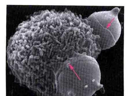 Fagocytoza Mikrografia elektronowa